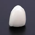 オールセラミック